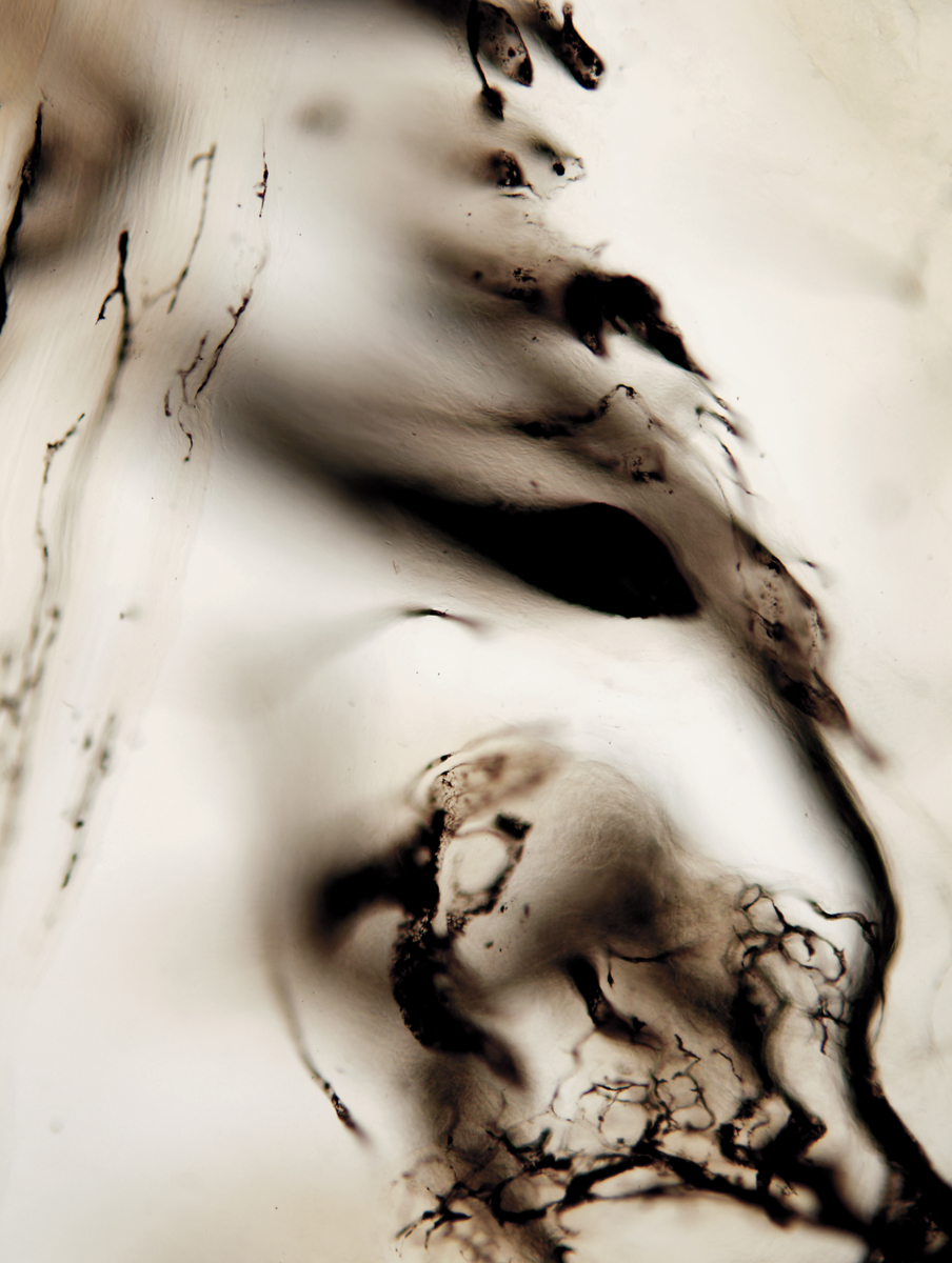 水墨印象-灌墨血管组织切片，X100，明视野，2011.jpg